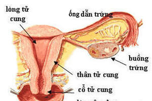 Biểu hiện rõ nhất của bệnh viêm ống dẫn trứng