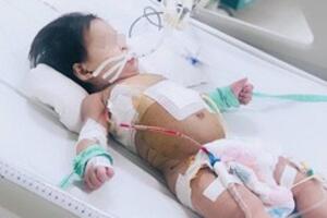Sốc: Bé gái 10 tháng tuổi thủng thực quản, phổi kháng tất cả kháng sinh