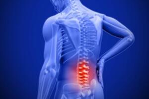 Ngồi nhiều sẽ sớm sinh bệnh đau lưng: Đây là giải pháp phòng chữa hiệu quả bạn nên áp dụng