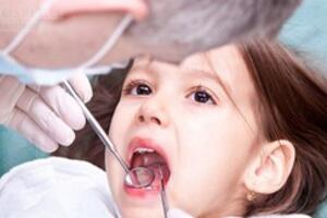 Cần nắn chỉnh răng cho trẻ ở tuổi nào?