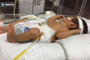 Hiếm gặp: Cháu bé sơ sinh 2 ngày tuổi ở Lào Cai bị vỡ dạ dày