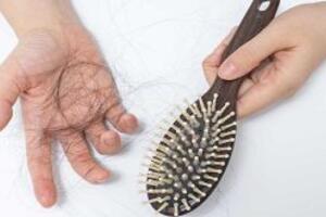 Rụng tóc – Nguyên nhân gây rụng tóc
