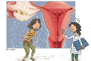 Những bất thường ở tử cung có thể gây vô sinh