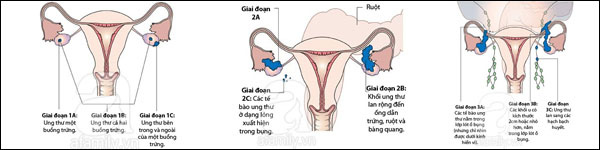 Những yếu tố tác động đến buồng trứng và sự rụng trứng 2