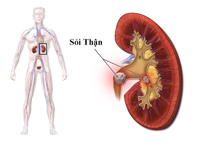 Uống nước khi bụng rỗng: Cơ thể nhận được 7 lợi ích thần kỳ nhờ thải độc, tu sửa tế bào - Ảnh 7.