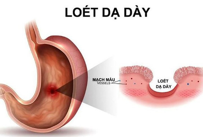 Máu không tinh khiết là nguyên nhân chính gây ra những bệnh này - Ảnh 2.