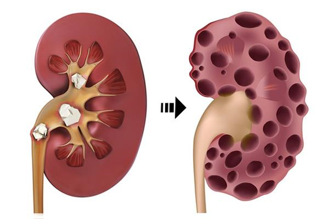 Cá diếc rất ngon và bổ dưỡng, nhưng 4 nhóm người này không nên ăn: Hãy xem có bạn không? - Ảnh 4.