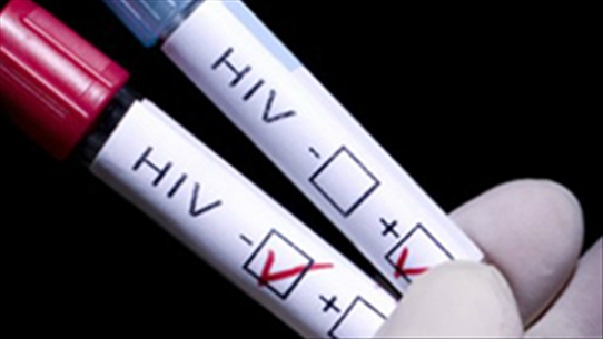 Xét nghiệm HIV