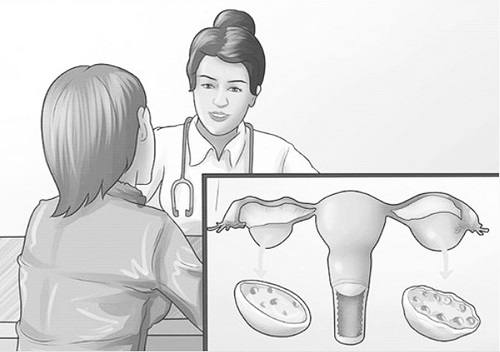 Rối loạn nội tiết gây rối loạn rụng trứng, ảnh hưởng khả năng đậu thai.