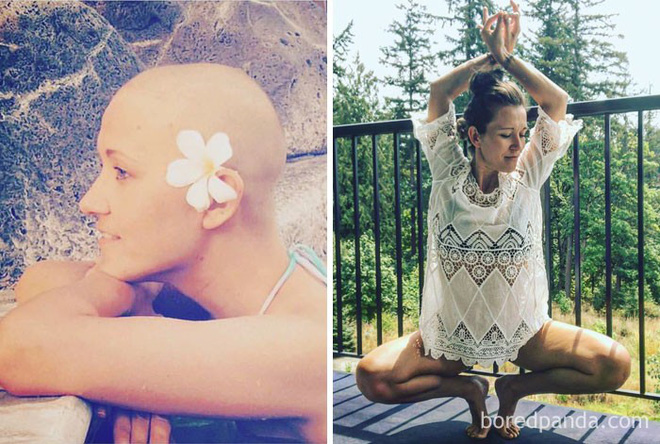Ngắm 10 bức ảnh có thể truyền cảm hứng mạnh mẽ về bệnh nhân ung thư sau khi chữa khỏi - Ảnh 8.