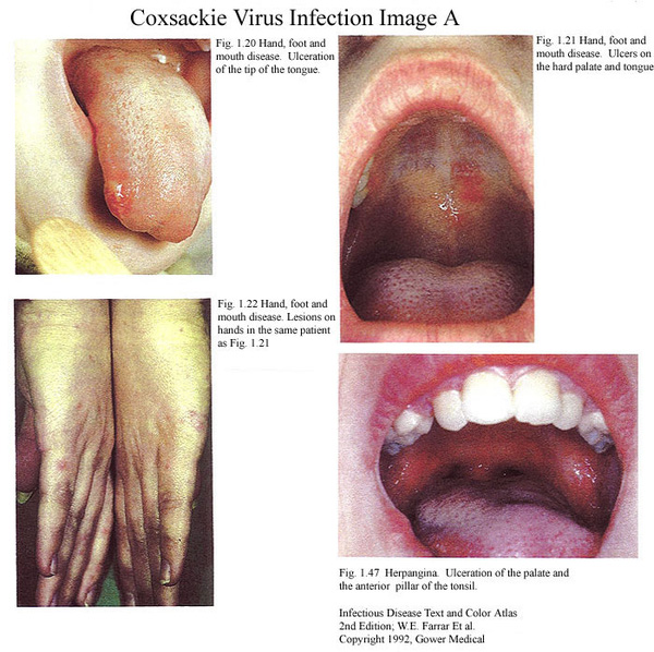 virus gây bệnh đường tiêu hóa