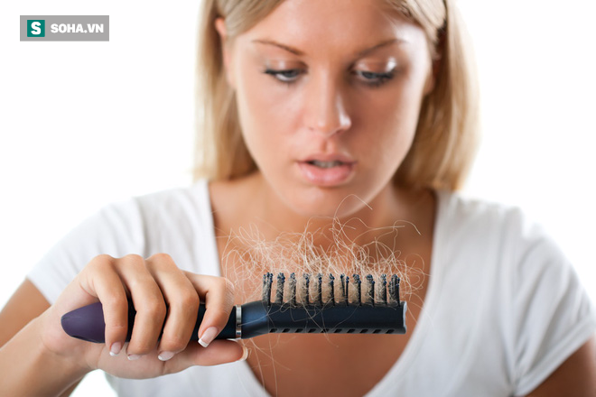 Ngày càng nhiều người trẻ bị rụng tóc: Hãy biết nguyên nhân để điều trị trước khi hói đầu - Ảnh 1.