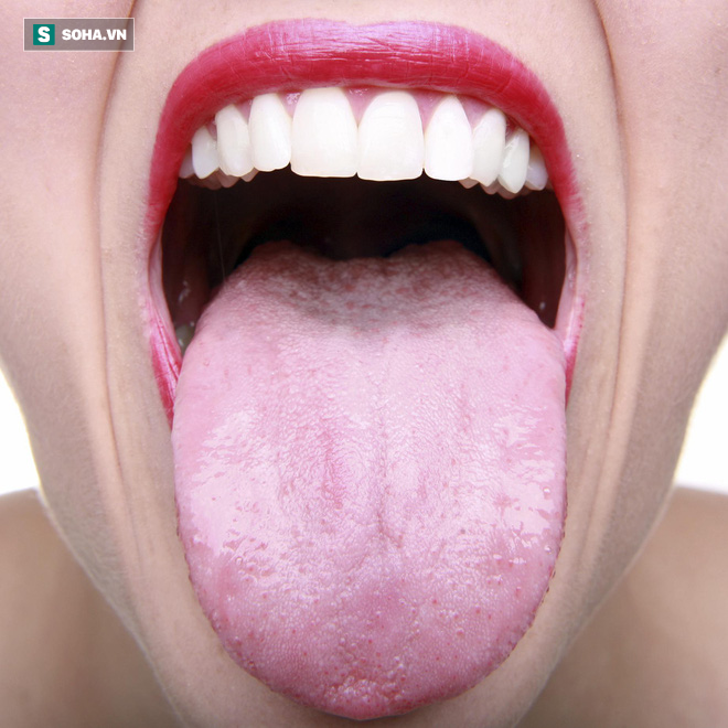 Có nên vệ sinh lưỡi mỗi lần đánh răng để ngừa hôi miệng: Nha sĩ trả lời rất thuyết phục - Ảnh 1.