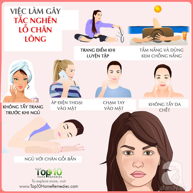 Hóa ra đây là việc có thể làm tắc nghẽn lỗ chân lông, gây mụn trứng cá nhưng chúng ta vẫn làm hàng ngày - Ảnh 1.