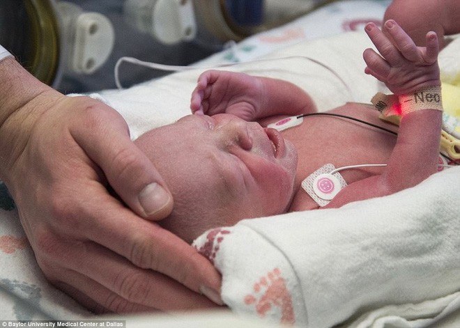 Trông có vẻ là một ca sinh bình thường nhưng đây là em bé chào đời theo cách đặc biệt nhất trên thế giới - Ảnh 5.