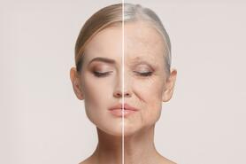 Glycation - nguyên nhân gây lão hóa nhanh hơn không chống nắng