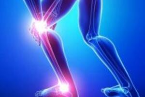 Những thảo dược chữa đau khớp hiệu quả dễ tìm