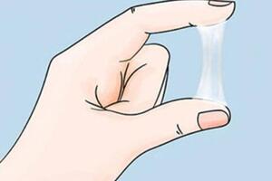 Khí hư màu trắng đục là dấu hiệu bệnh gì?