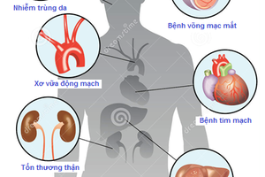 Các biến chứng của bệnh đái thao đường đang ở mức báo động