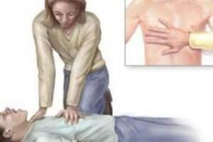 Hồi sức tim phổi (CPR)