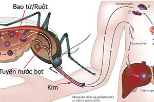 Bài thuốc Nam trị sốt xuất huyết