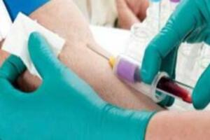 Các xét nghiệm máu phát hiện viêm