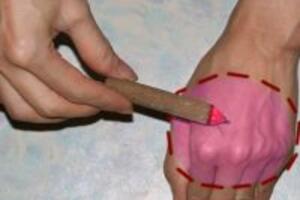 Mẹo chữa đau nhức đầu mà không cần thuốc