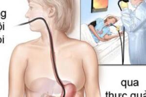 Nội soi dạ dày (Gastroscopy)