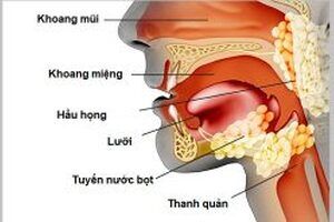 Những nét chính về ung thư vùng đầu – cổ