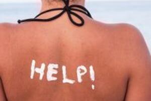 Bạn đang tìm cách trị da bị cháy nắng? Chuyện nhỏ