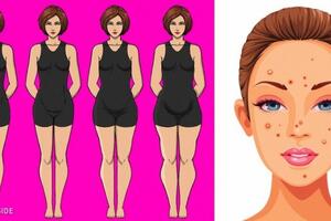 Sau Tết, nhiều người dễ bị rối loạn nội tiết và đây là 12 triệu chứng chị em cần nhận ra