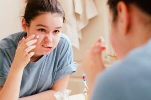 Hướng dẫn cách trị mụn nhanh và hiệu quả từ dầu dừa