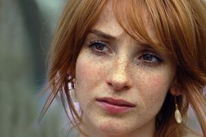 Giải cứu làn da thâm nám 4 với cách trị nám 100% tự nhiên