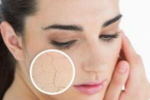 Cách phân biệt giữa da khô và da bị mất nước