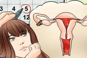 Nếu kinh nguyệt không đều, đừng quá lo lắng vì đây có thể là nguyên nhân