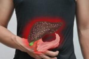 Mách bạn 7 bài thuốc chữa bệnh sỏi mật bằng thuốc nam