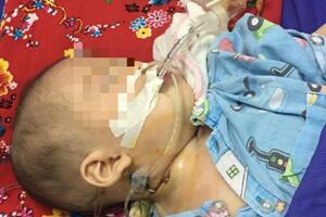 SOS: Hãy dừng ngay cho trẻ uống thuốc cam không rõ nguồn gốc