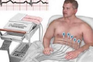 Điện tâm đồ (ECG)