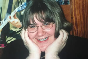 Chỉ 1 hành động của bác sĩ mà người phụ nữ có lông rậm khắp người này không còn tự ti và muốn khoe ra cho mọi người thấy