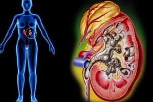 Triệu chứng của suy thận cấp