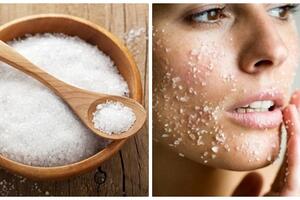Trị mụn và sẹo thâm bằng muối chỉ trong 1 tuần