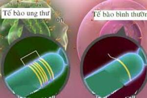 Điều trị ung thư vú bằng phương pháp mới lạ