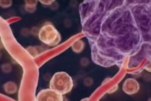 Tác dụng của fucoidan ngăn ngừa ung thư hiệu quả