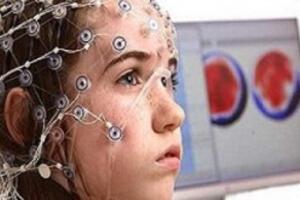 Điện não đồ (EEG)