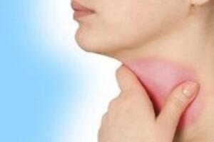 Bài thuốc đơn giản nhất để trị viêm họng ngay tại nhà