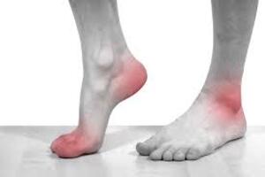 Những điều nên tránh trong ăn uống đối với bệnh nhân gút