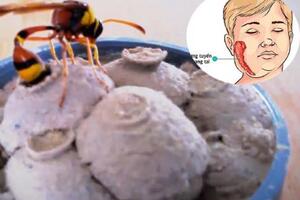 Người mẹ trẻ đứng ngồi không yên vì trót chữa quai bị cho con bằng tổ tò vò