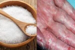 3 cách chữa tổ đỉa bằng muối an toàn, hiệu quả