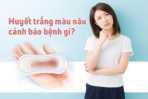 Nguyên nhân nào khiến huyết trắng màu nâu?