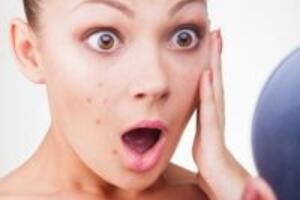 Ăn gì để trị mụn bọc hiệu quả nhất?